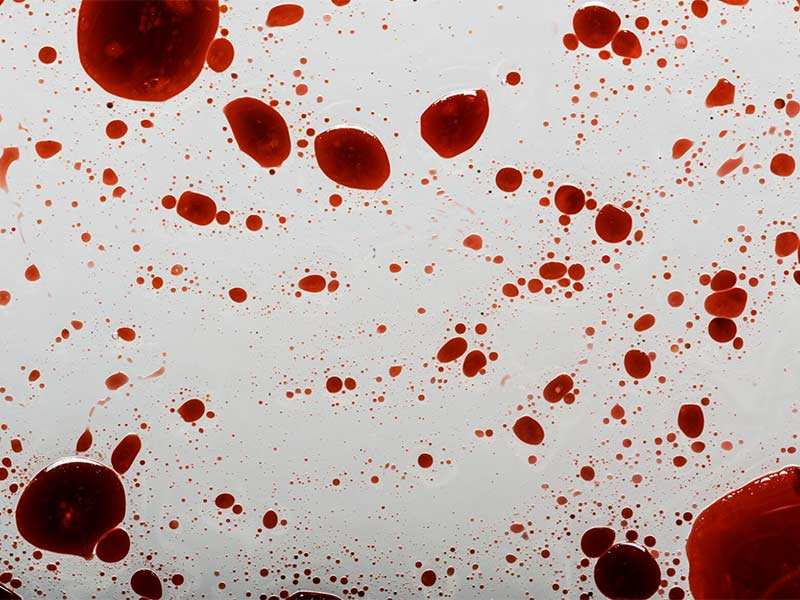 quitar manchas sangre